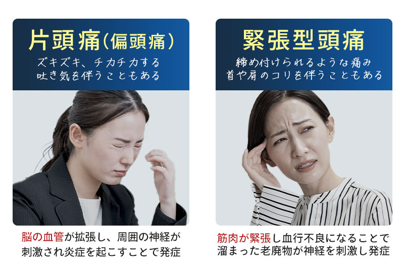 片頭痛(偏頭痛)と緊張型頭痛の違い